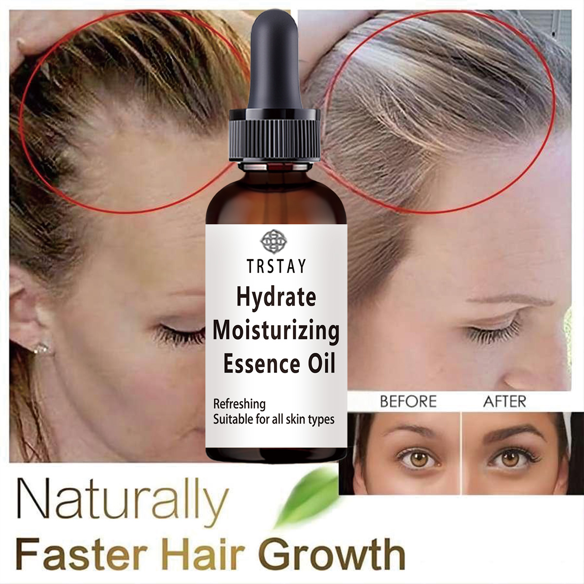 Biotin Hair Growth - Neue Rizinusöl Haar Wachstum Ätherische Öle