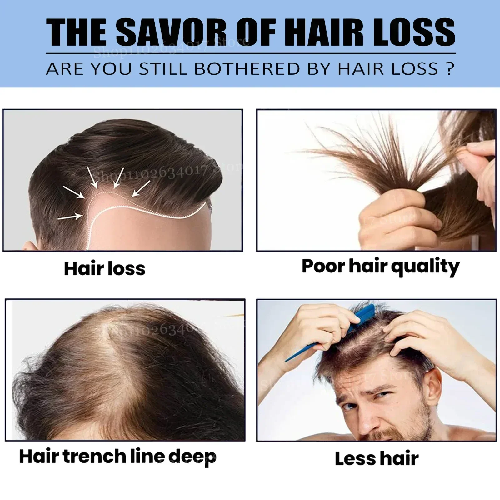 1ST Stärktes Haar, nährt die K – Biotin Hair Growth Bewertung und Preis