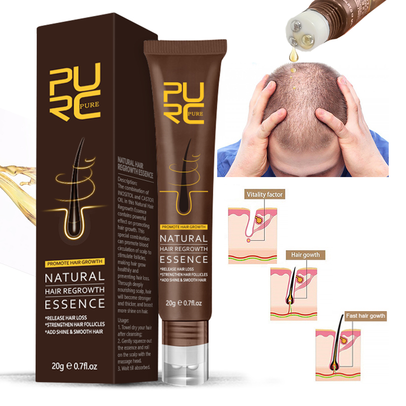 PURC 300 ml Biotin Shampoo Ing – Biotin Hair Growth Bewertung und Preis
